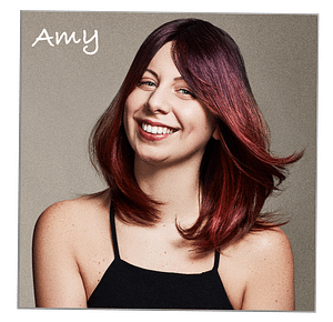 Amy Alopecia Universalis